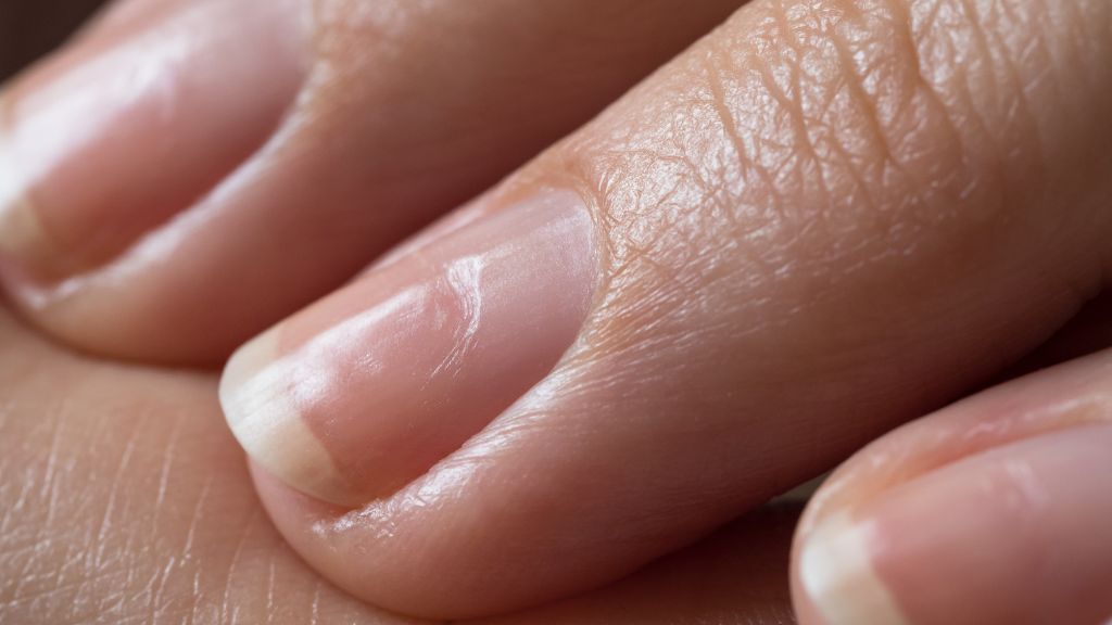 onycholiza paznokci jakie są jej przyczyny i jak ją leczyć