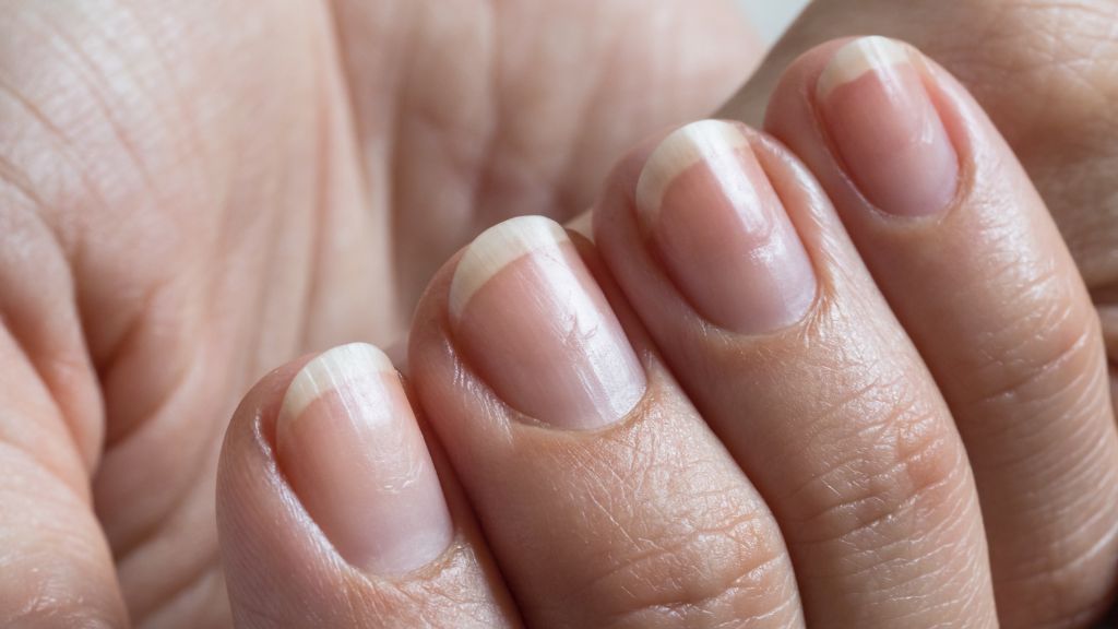 leczenie onycholizy paznokci